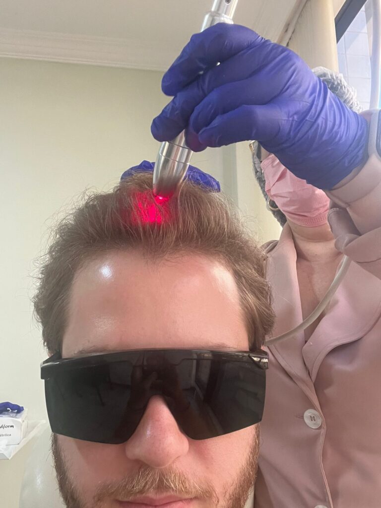 Laserterapia