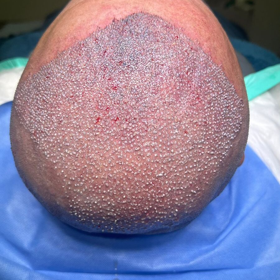Dia do Transplante